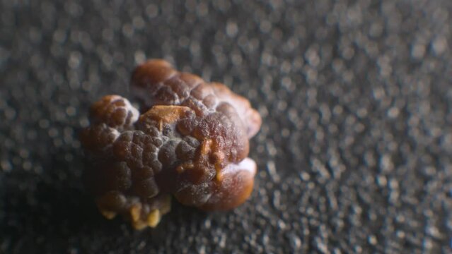 Close-up of a kidney stone. Neoplasm urolithiasis of the kidneys. nephrolithiasis - Closeup shot of a kidney stone renal calculus or nephrolith on a black porous background.