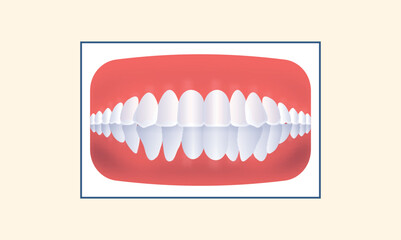 Crowding Human Teeth Icon Over Yellow Background.