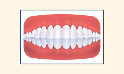 Overbite Human Teeth Icon On Yellow Background.