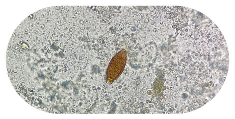 Fototapeta premium Egg of Trichuris trichiura (whipworm) in stool, analyze by microscope