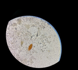 Egg of Trichuris trichiura (whipworm) in stool, analyze by microscope
