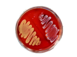 Petri dish isolated with Bacterial colony on blood agar meidum. Microbial culture. white background.