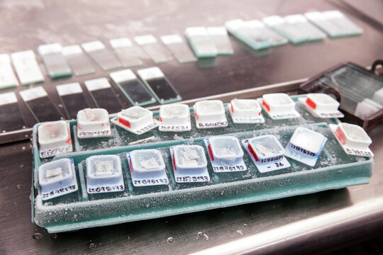 Frozen blocks of paraffin embedded tissue kept cold on ice ready to be cut using a microtome. Paraffin blocks containing biopsy tissue for sectioning. Pathology laboratory. Cancer diagnosis.