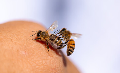 A bee on a person's hand close-up. Insect bite. A bee crawls over a person's skin.