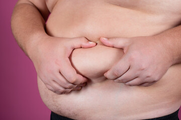 A fat man holds his stomach. Male waist. Diet and weight loss. Obesity.