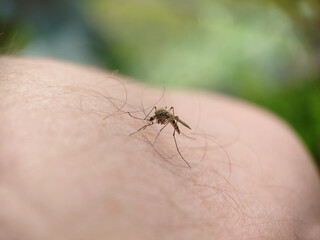 Fototapeta premium A striped mosquito landed on a human hairy leg