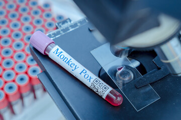 Fototapeta premium Blood test samples tube, reagent testing tube and swab collection kit in the laboratory, Monkey pox testing process. ,PCR DNA testing protocol process.