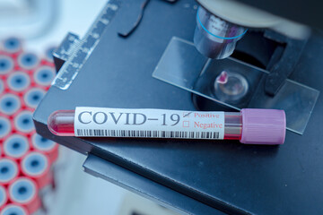 Blood test samples tube, reagent testing tube and swab collection kit in the laboratory,...