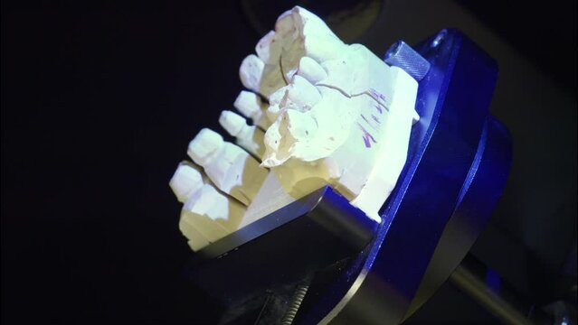 3d dental scanning