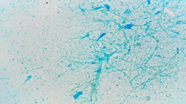 Preparation for microscopy Motor end plate whole mount square shaped magnification 100x. Laboratory medical examination of human brain nerve cell tinted blue. Scientific research anatomy of man body.