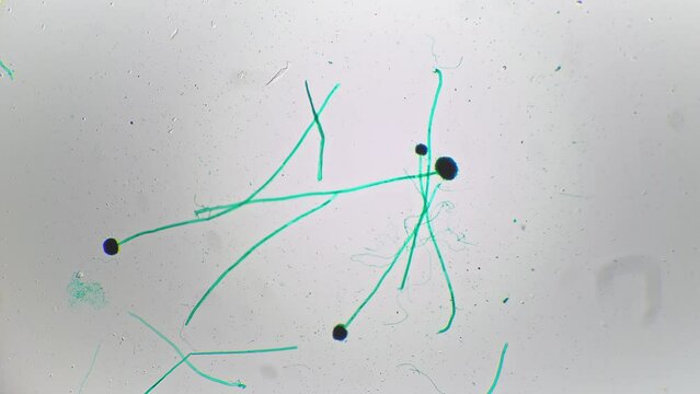 Whole mount of aspergillus filmed under microscope against bright field with 40 magnification. Dangerous fungus causing allergy learnt at laboratory with special scientific equipment to view structure