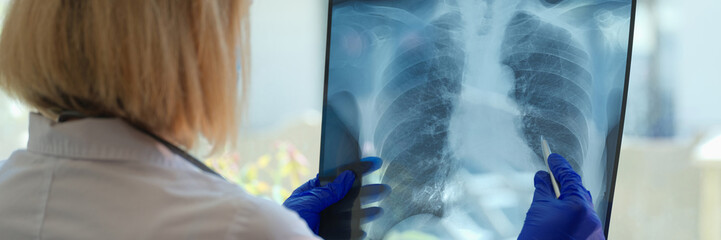 Doctor diagnoses health status of patient with asthma, lung diseases and COVID-19