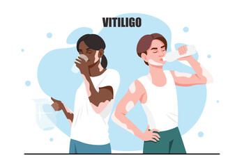 Fototapeta na wymiar Concept of vitiligo