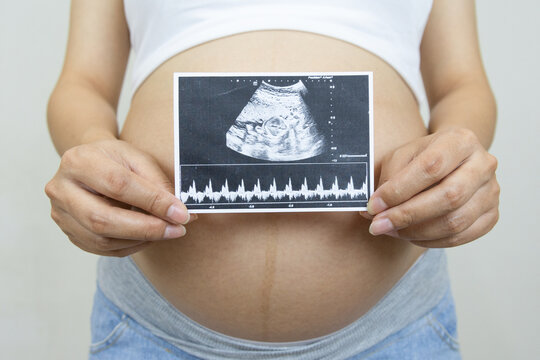 Close up pregnant woman holding ultrasound image. Concept of pregnancy, Asian Young mother waiting of the baby.