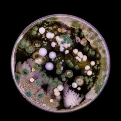 Samples of Petri dishes with a culture of microorganisms and fungi in the surface of agar nutrient...