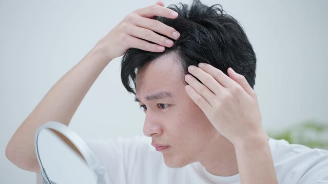 若い男性・薄毛・ハゲ	