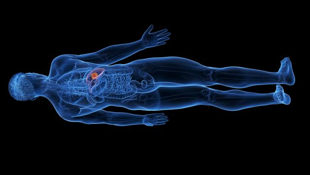 3d rendered medical animation of a liver tumor