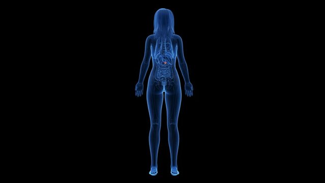 3d rendered medical animation of a pancreas tumor