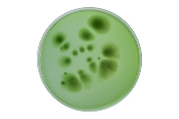 Petri dish and culture media with bacteria on white background with clipping, Test various germs, virus, Coronavirus, Corona, COVID-19, Microbial population count. Food science.