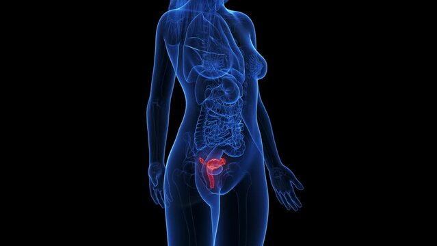 3d rendered medical animation of an inflamed uterus