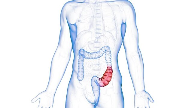 3d rendered medical animation of a constipated colon