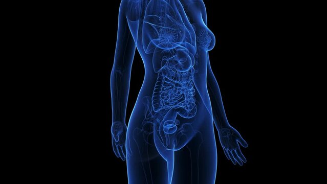 3d rendered medical animation of rectal  cancer