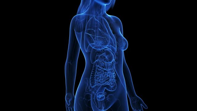 3d rendered medical animation of pancreas cancer