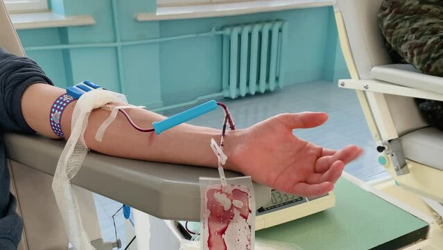 The hand of a man who donates blood. Male donor gives blood in a mobile blood donation center. Blood samples