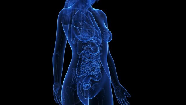 3d rendered medical animation of colon cancer