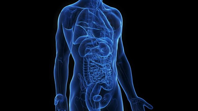 3d rendered medical animation of small intestine cancer