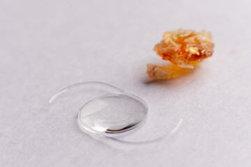 closeup photo of real eye lens removed from human suffering from cataract beside artificial intra...
