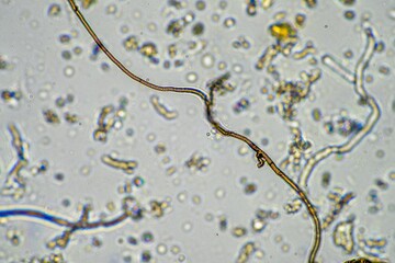 soil sample under the microscope. soil fungi and microorganisms cycling nutrients in compost