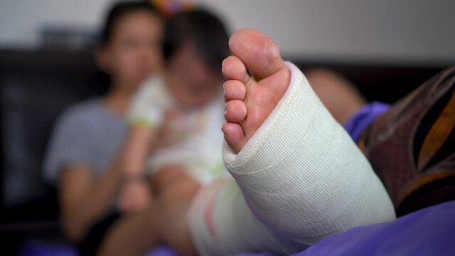 Close of gypsum broken leg. Mother love hugging baby