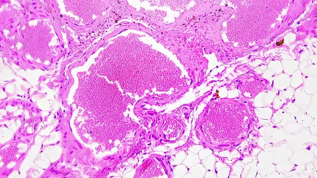 Intestine in longitudinal section magnified under microscope in 200 times on bright field. Internal tissues of human stomach with pink cells. Investigating anatomy and microbiology in the laboratory.