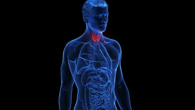 3d rendered medical animation of an inflamed thyroid