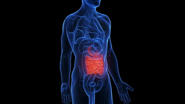 3d rendered medical animation of an inflamed small intestine