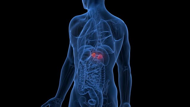 3d rendered medical animation of an inflamed adrenal gland