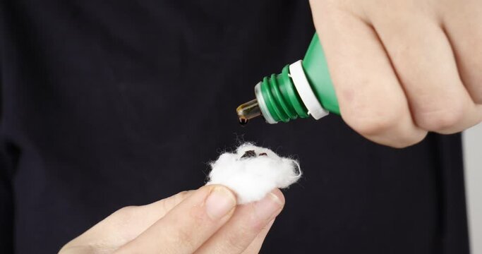 cotton wool and iodine, treatment of radioactive exposure with iodine solution. High quality 4k footage