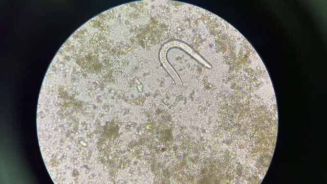 strongyloides stercoralis larva in stool exam finding with microscope 40X.