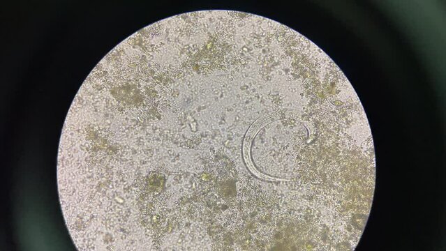 strongyloides stercoralis larva in stool exam finding with microscope 40X.