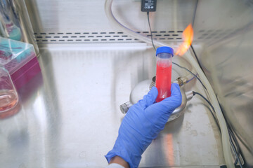 The researcher using bunsen burner to sterile technique for kill the pathogen or bacteria and prevent the contamination in the cell culture media in the laboratory room. The lab test in the laboratory