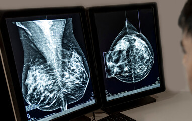 A doctor radiologist in a hospital mammography analysis room reading X-rays of a chest, breast and...