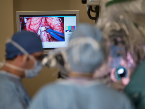 in neurosurgery surgery, neurosurgeons operate with microscopes with high imaging technology, O-arm navigation system in spine surgery. Stereotactic Imaging in Deep Brain Stimulation Surgery