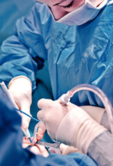 Surgeon and his assistant performing cosmetic surgery in hospital operating room. Surgeon in mask wearing loupes during medical procadure. Breast augmentation, enlargement, enhancement, breast cancer