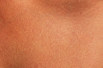 Fototapeta premium Brown human skin texture. Sunburned woman skin closeup