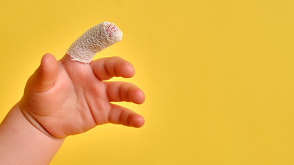 Baby s hand with a bandaged finger on a yellow studio background, copy space. Injured index finger of a child wrapped in a white bandage. Kid boy aged one year and three months