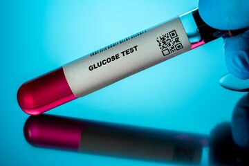 Glucose Test Blood Tests for Older Adults. Recommended Blood Test for the Elderly