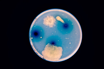 Petri dish with colonies of bacteria in a microbiology laboratory
