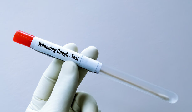 Scientist holding swab sample for whooping cough test, a disease by Bordetella pertussis bacteria. 