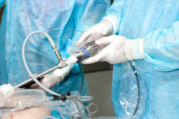 Hands of surgeons in white gloves during laparoscopic abdominal surgery. Selective focus. Surgery...